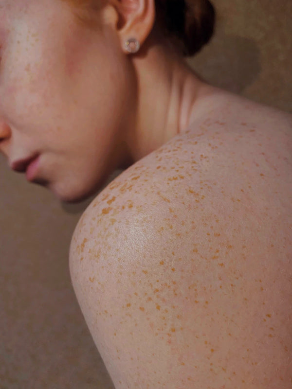 Get Glowing Identify  Treat Common Skin Conditions
